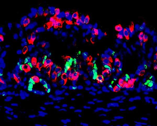 Una sezione gastrica del mini-organo progettato per produrre cellule che secernono insulina, con colorazione a immunofluorescenza. Questa immagine mostra molte cellule che producono insulina indotta (rosso) presenti nel mini-organo. staminali gastriche e cellule progenitrici (verde) vengono rilevate alla base delle ghiandole. nuclei delle cellule etichettati in blu. Credit: Chaiyaboot Ariyachet